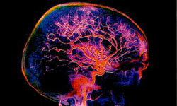 cerebromemoria.jpg